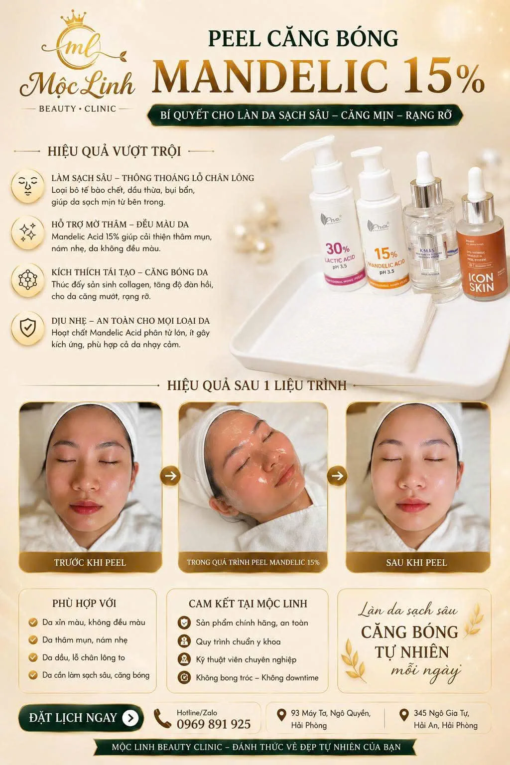 Cải thiện lỗ chân lông to tại Thẩm Mỹ Mộc Linh Hải Phòng - hình 1