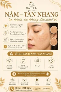 Nám - tàn nhang - Trị nám tại Thẩm mỹ viện Mộc Linh Hải Phòng