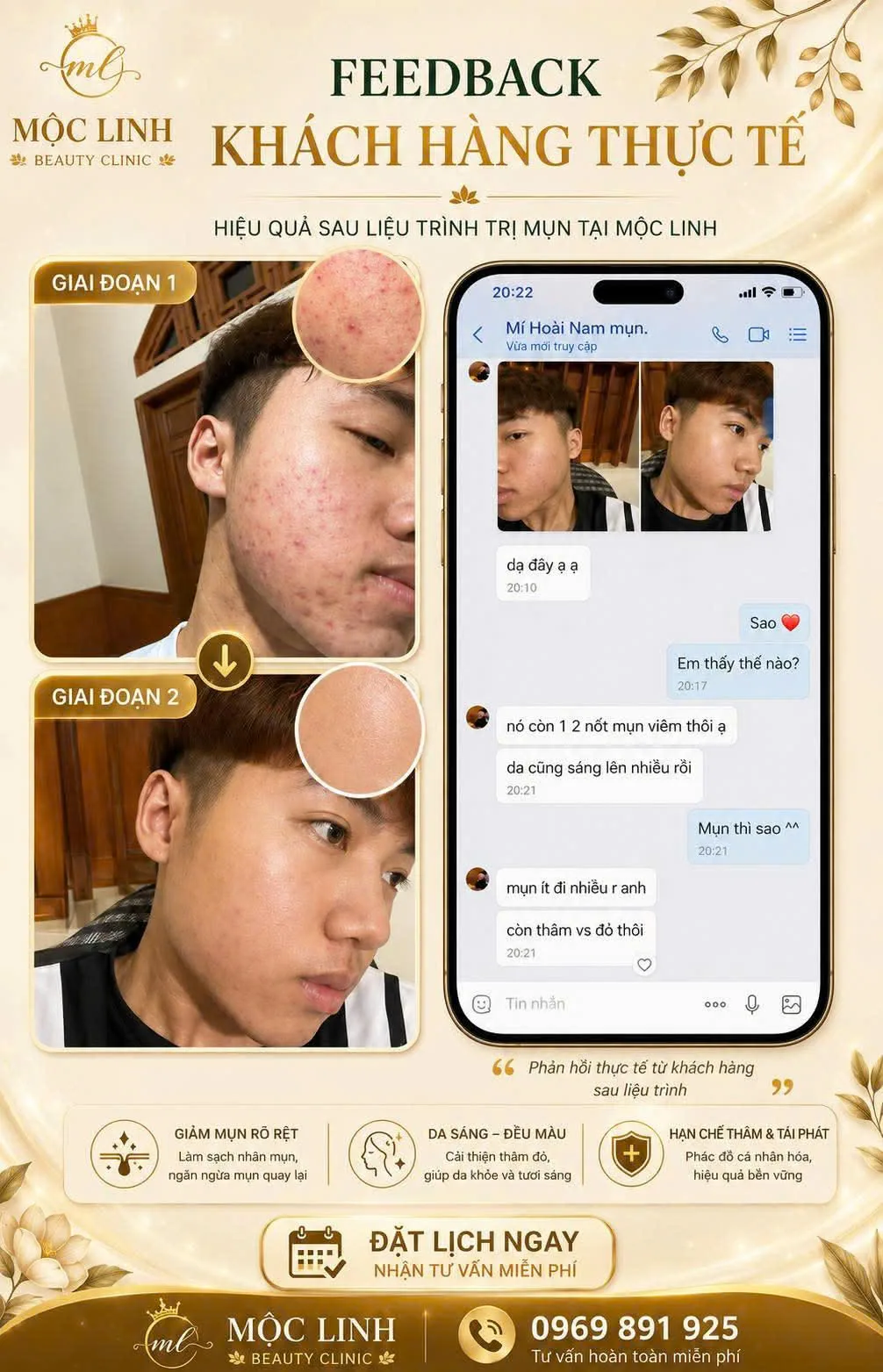 Feedback khách hàng triệt lông hiệu quả tại Thẩm Mỹ Mộc Linh Hải Phòng
