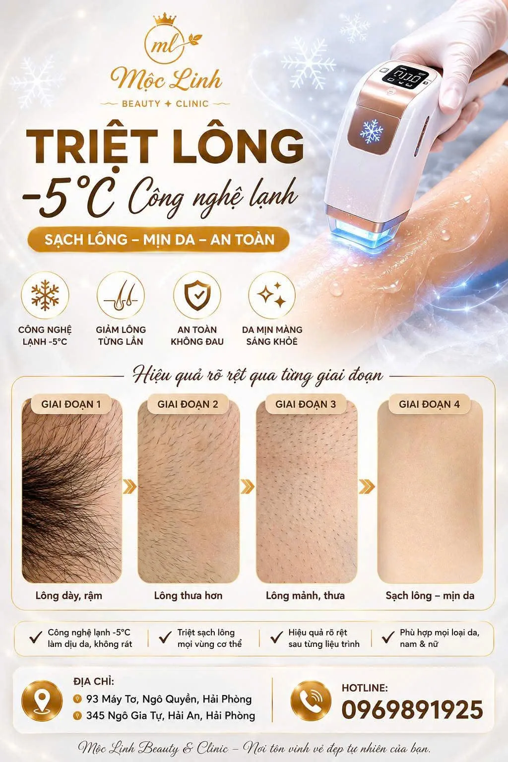 Triệt lông cho nam bằng công nghệ laser tại Thẩm Mỹ Mộc Linh Hải Phòng